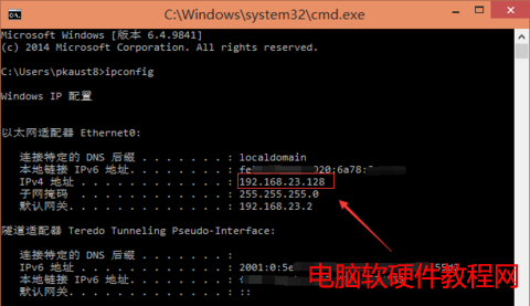 Windows ip配置界面