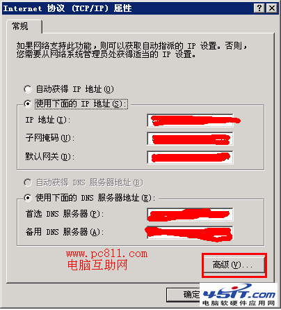 TCP/IP高級設置